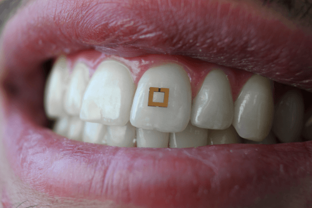 Científicos desarrollan pequeños sensores montados en los dientes que pueden rastrear lo que comes
